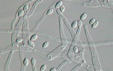 Paecilomyces_variotii_1640125278