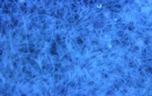 nematodos-2