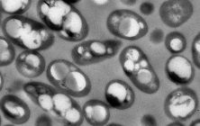 bacterias-mutantes-produciendo-plastico.-CIB
