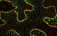 Imagen-de-microscopia-confocal-con-la-localizacion-de-la-proteina-Sinaptotagmina-1-unida-a-la-proteina-fluorescente-GFP.