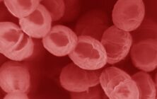 Lactococcus_lactis